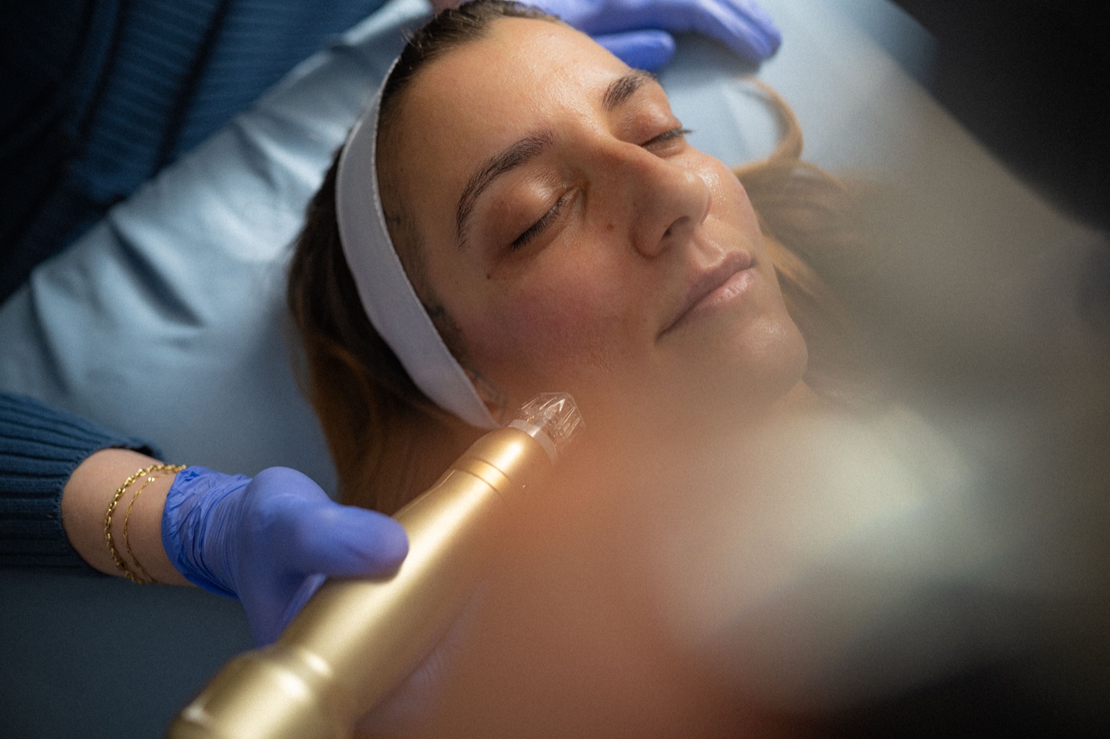 Facial treatment at Dr. Gail King's clinic